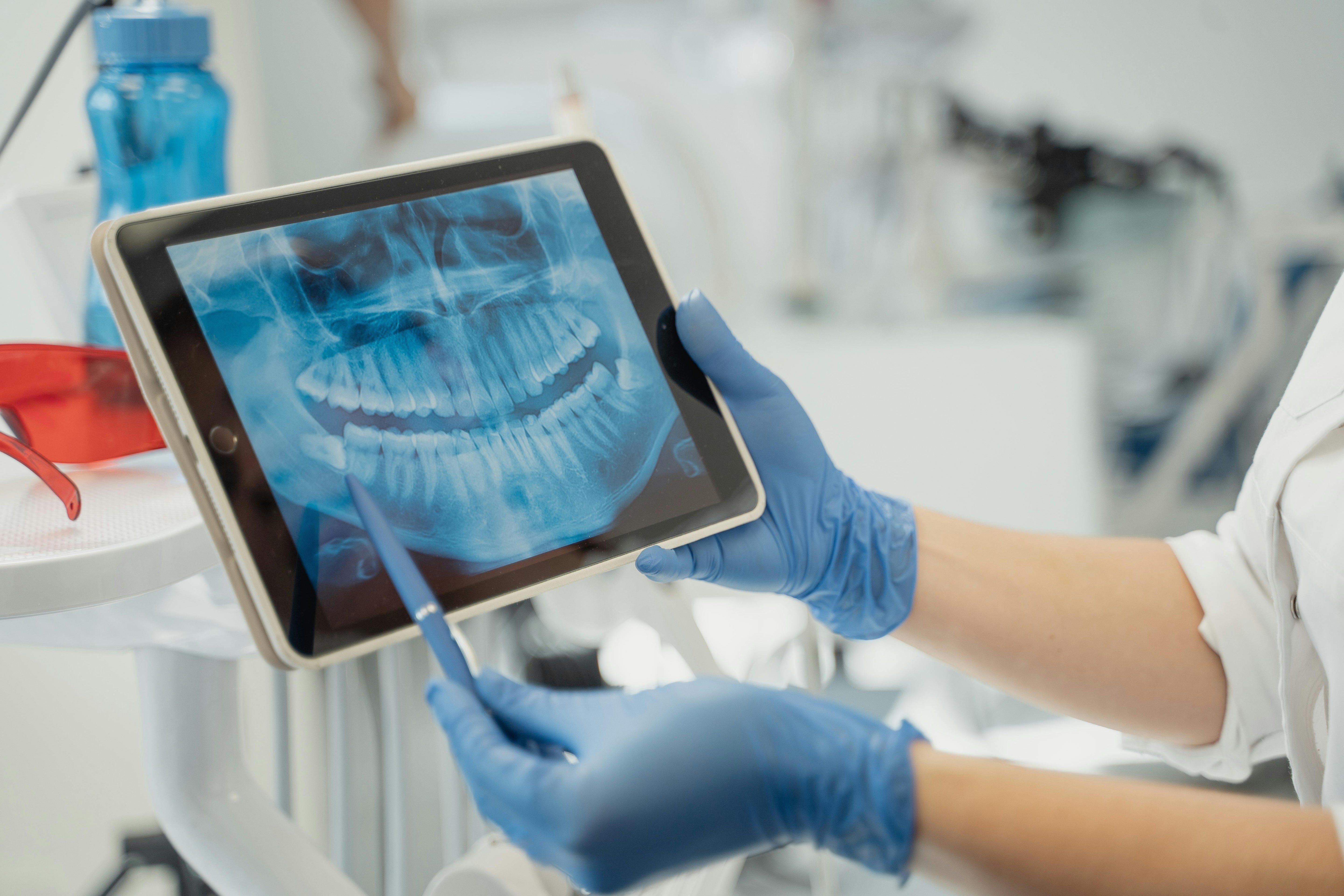 How to Find a Dentist Who Fits Your Needs