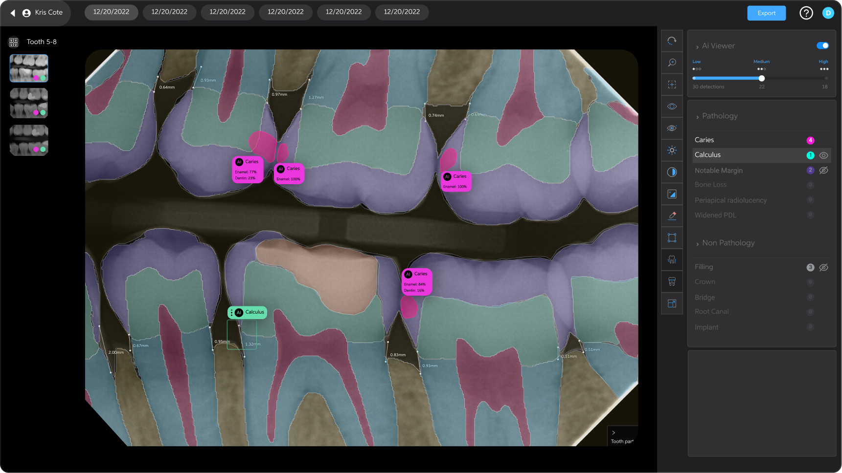 AI-Powered Dental Diagnostics in 2026: How to Find Dentists Using Advanced Technology Near You