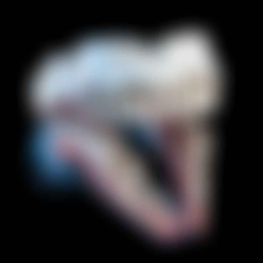 3D dental radiography image showing a detailed view of teeth and jaw