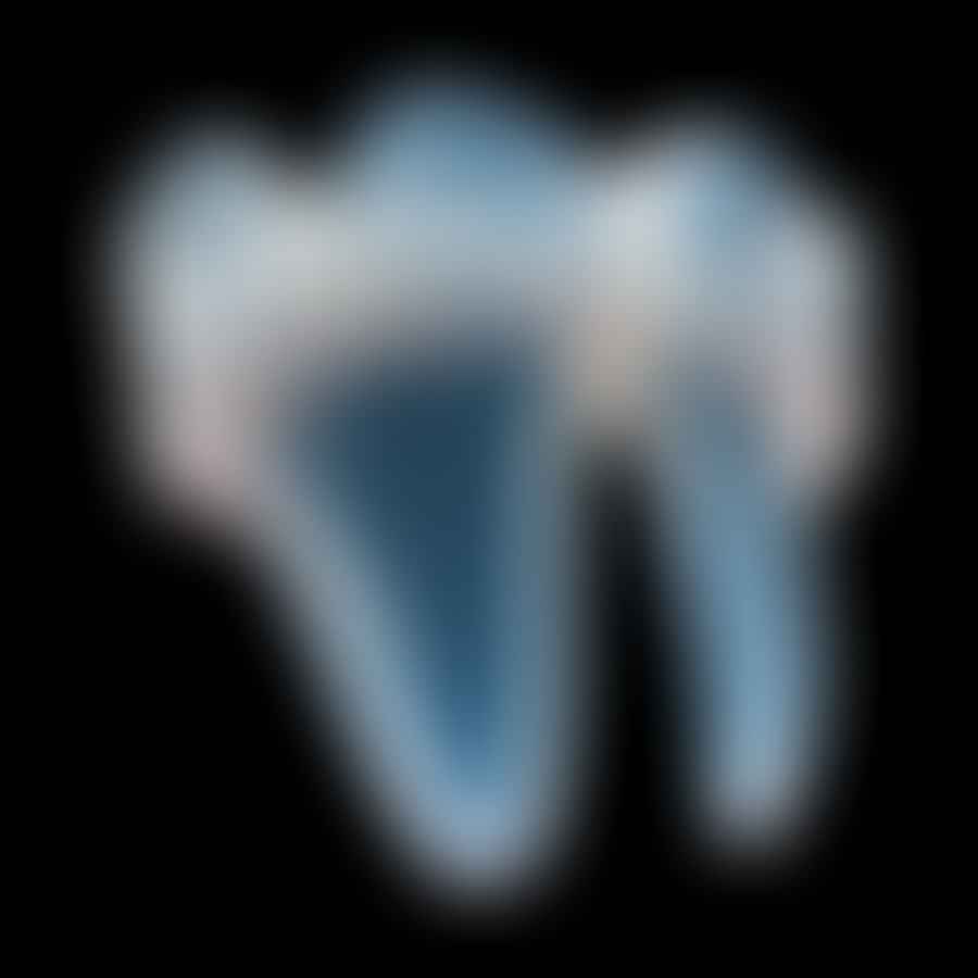 3D dental radiography image