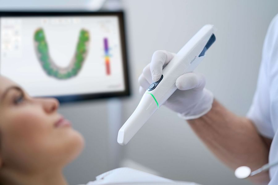 intraoral scanner in dentistry