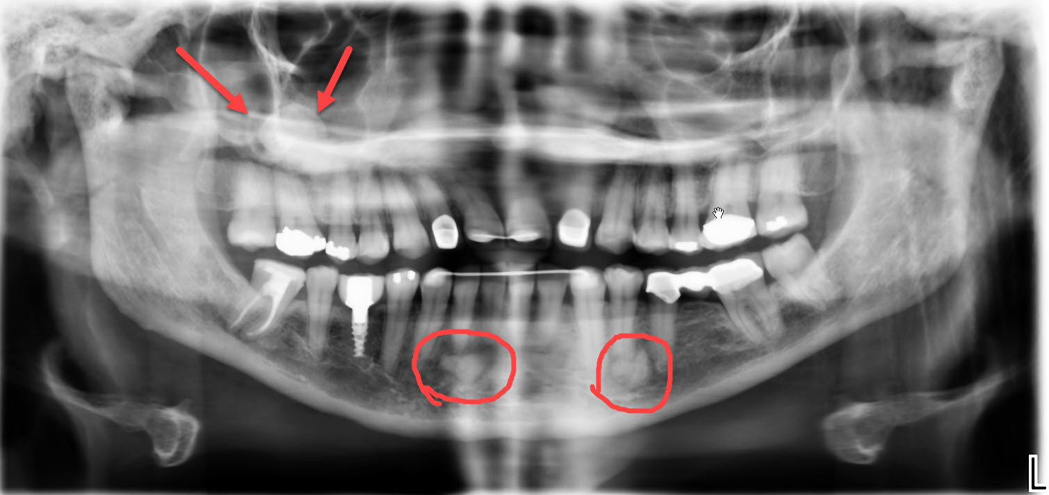 3D Cone Beam CT Imaging in dentistry