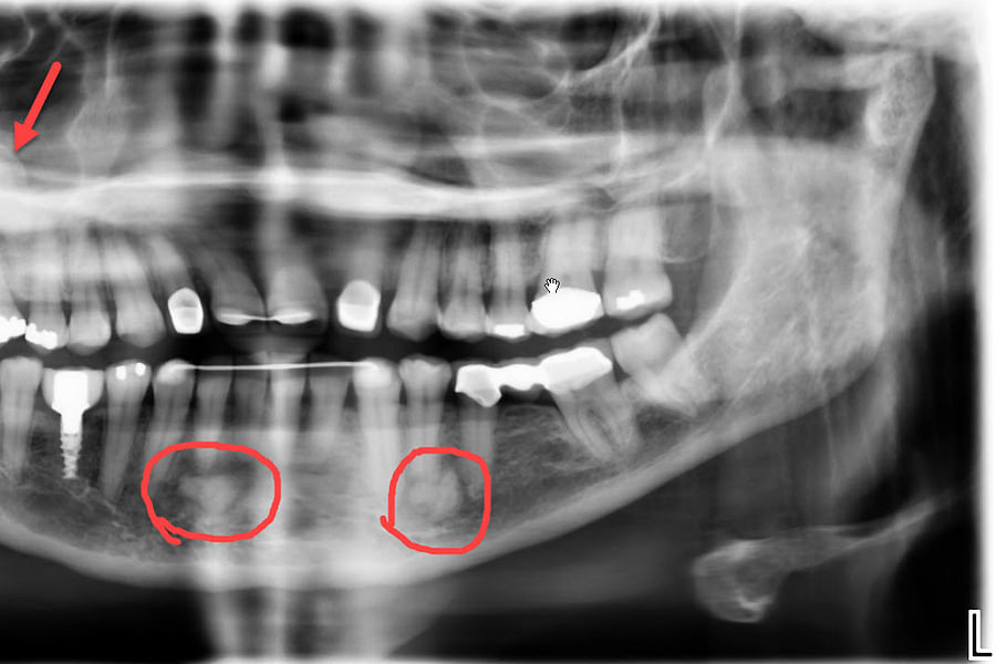 3D Cone Beam CT Imaging in dentistry