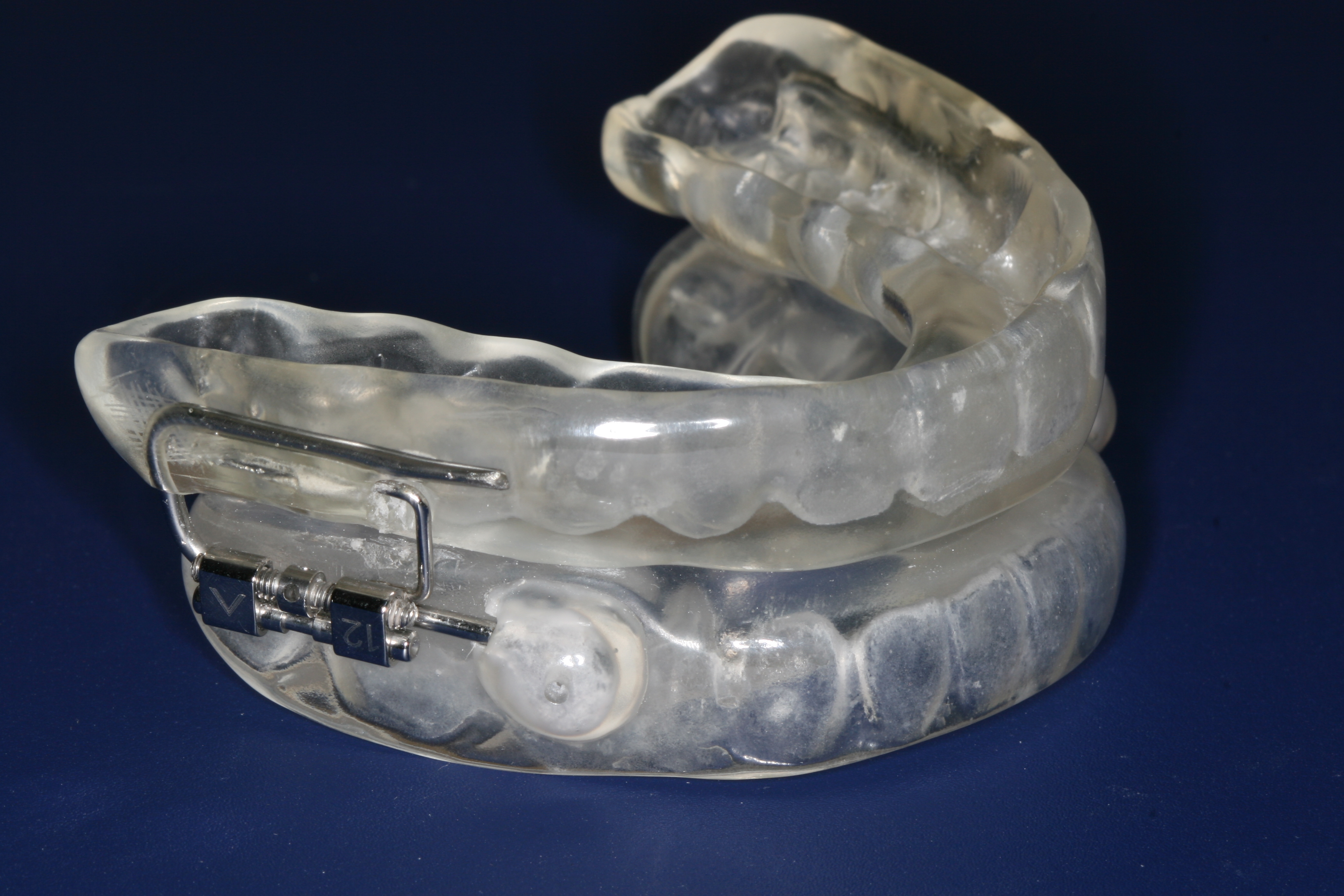 Dental sleep apnea oral device