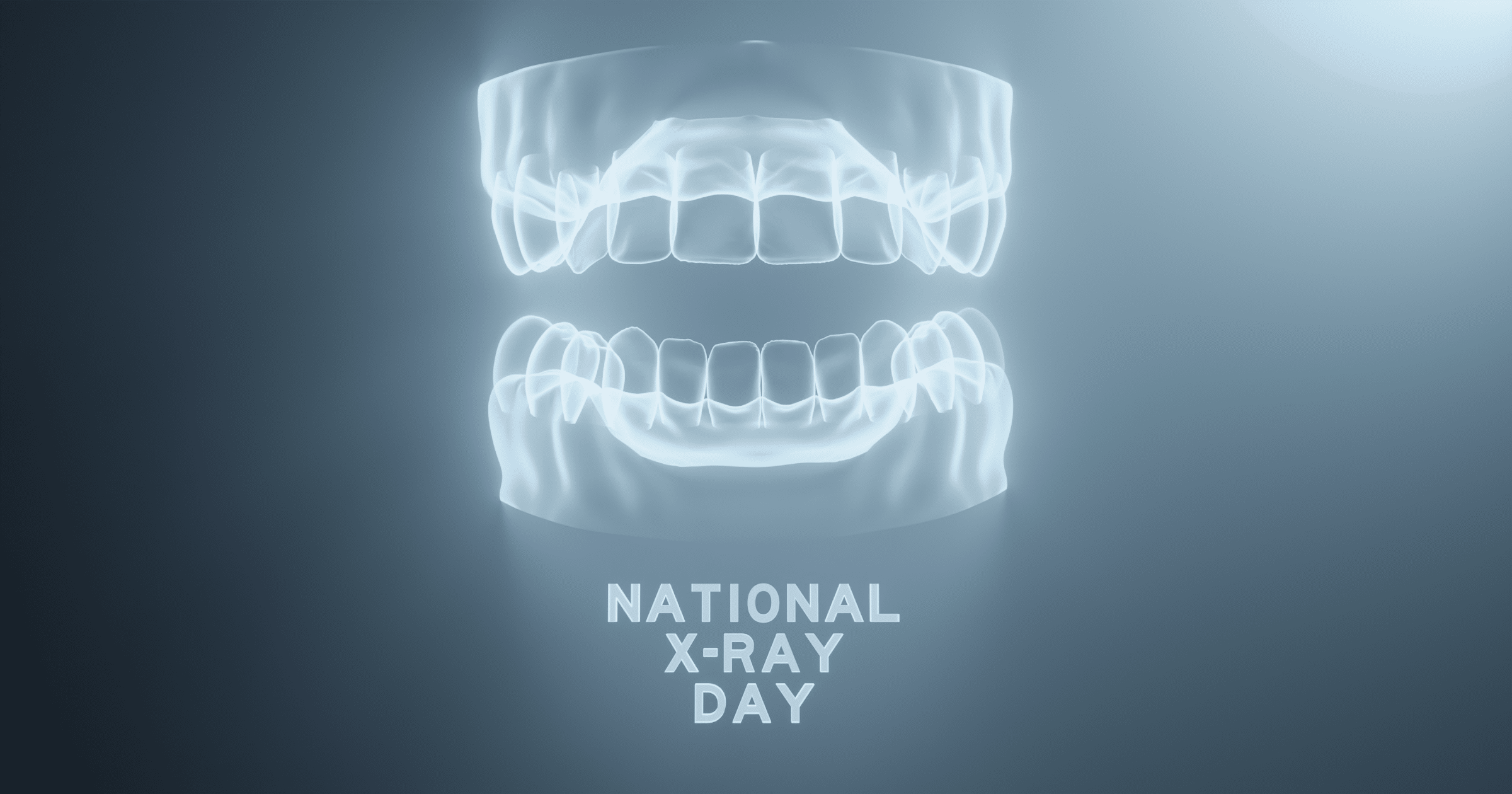dental x-ray bone loss