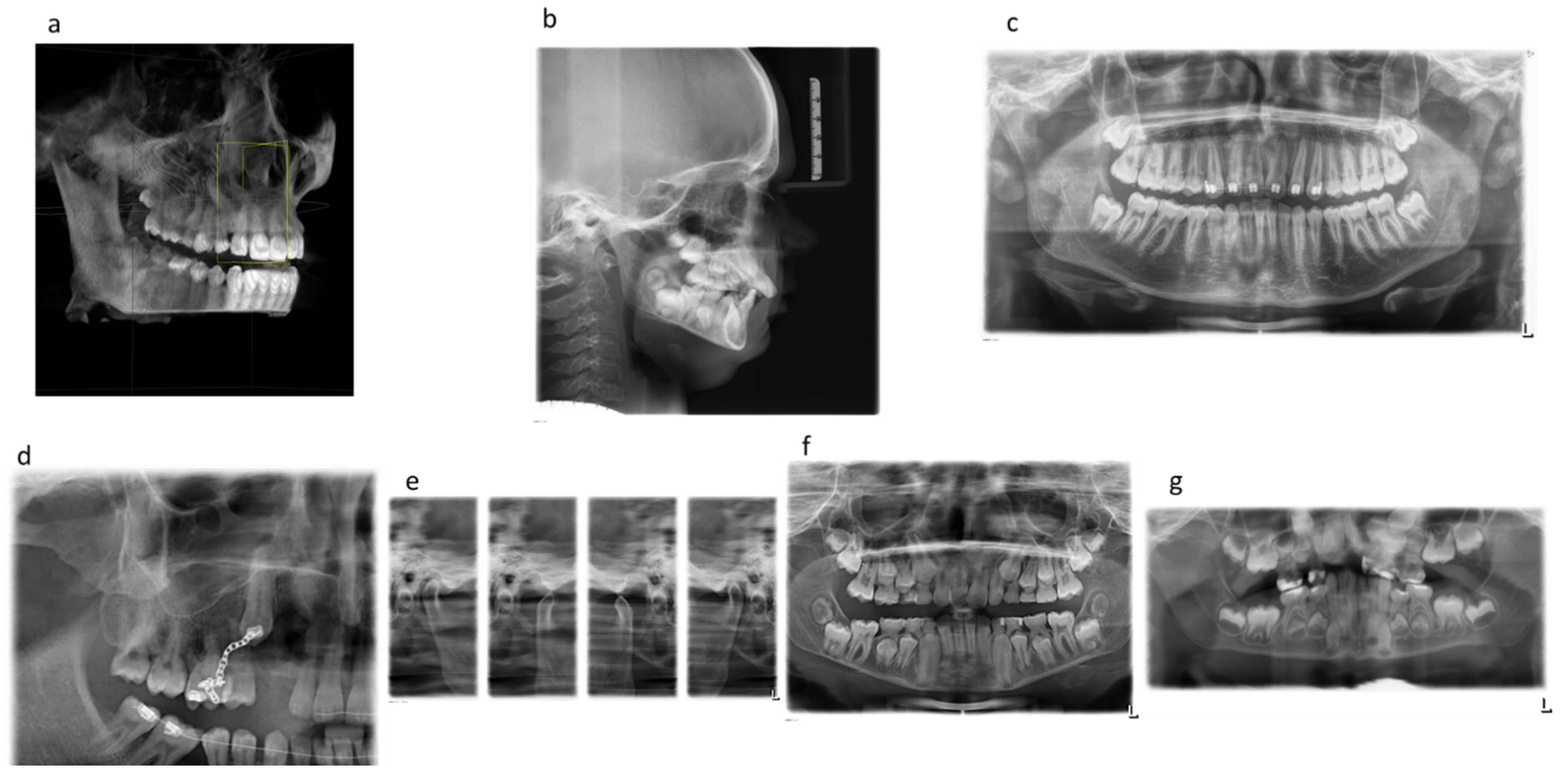dental x-ray for orthodontic planning