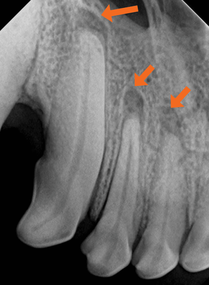 dental x-ray hidden dental structures