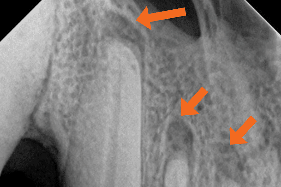 dental x-ray hidden dental structures
