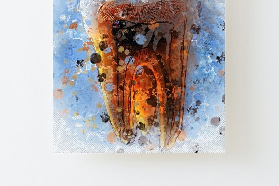 dental smile canvas print