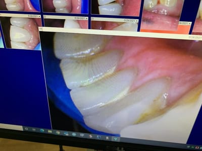 21st Century Dental of Irving