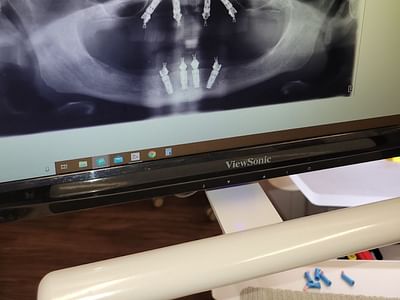 360 Family and Implant Dentistry- Dr. Ticole Nguyen and Dr. Christopher Gonzales