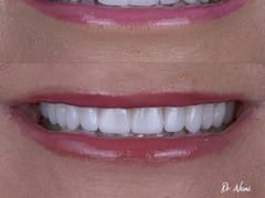 3D SMILE - Cosmetic Dentist