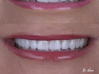 3D SMILE - Cosmetic Dentist