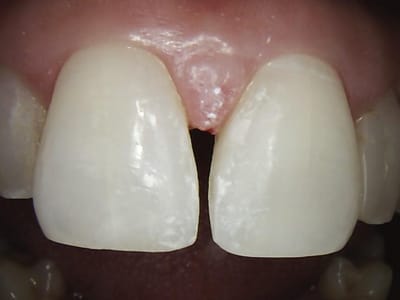 ABQ Gentle Dentistry