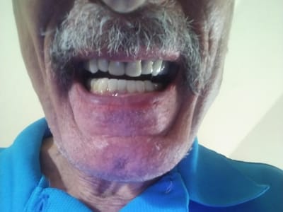 Absolute Dental Care