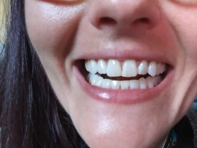 Absolute Dental - Topsy