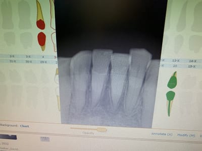 Access Dental, Dentures & Implants