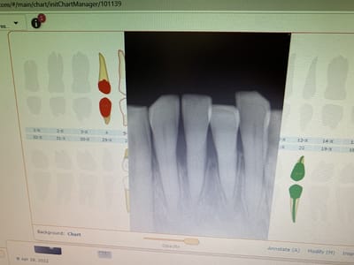 Access Dental, Dentures & Implants