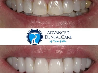 Advanced Dental Care of Twin Falls