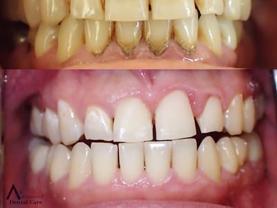 Advanced Dental Care