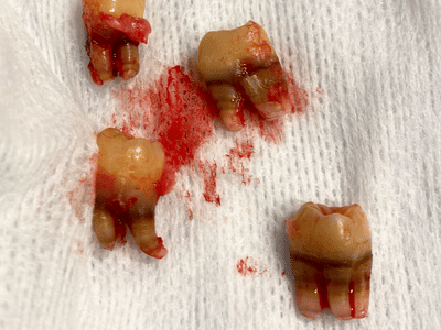 Advanced Dental Care