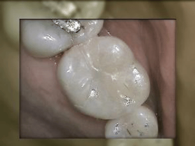 Advanced Dental Care