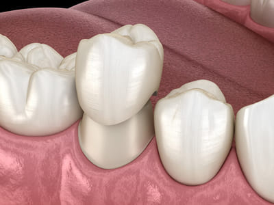 Advanced Dental Health