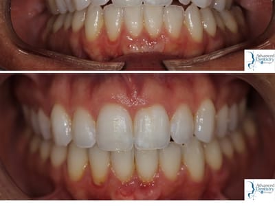 Advanced Dentistry by Design