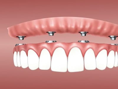 Advanced Dentistry & Implant Center of Scottsdale