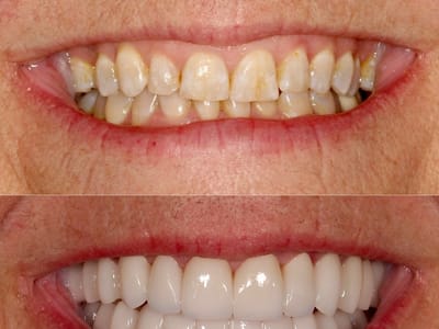 Advanced Dentistry of Amarillo