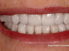 Advanced Dentistry of Amarillo