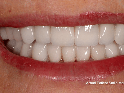 Advanced Dentistry of Amarillo