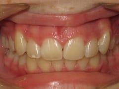 Advanced Family Dentistry & Braces