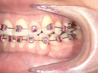 Advanced Family Dentistry & Braces