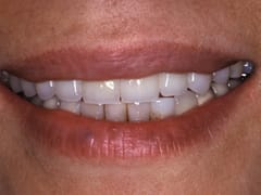 Advanced Restorative Dentistry