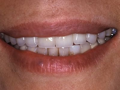 Advanced Restorative Dentistry