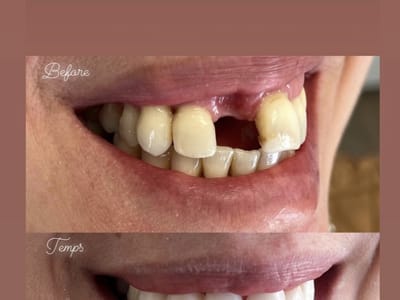 Aesthetic Dentistry of Rockland County