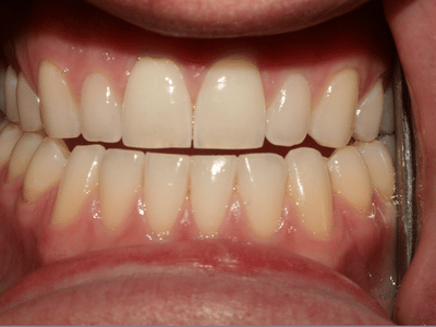 Aesthetic Family Dentistry, PA