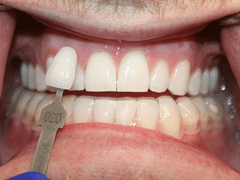 Aesthetic Family Dentistry, PA