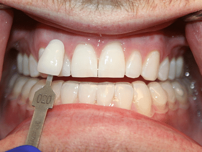 Aesthetic Family Dentistry, PA