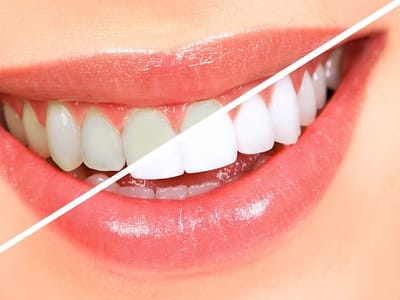 Aesthetic Family Dentistry