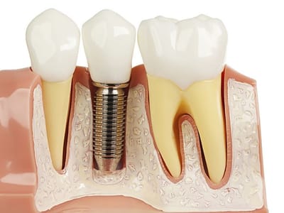 Aesthetic Family Dentistry