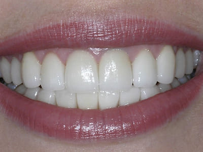 Aesthetic Smiles Family & Cosmetic Dentistry