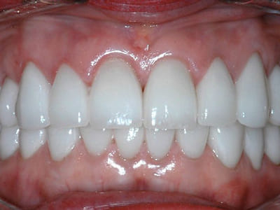 Aesthetic Smiles Family & Cosmetic Dentistry