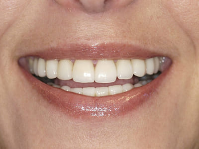 Aesthetic Smiles Family & Cosmetic Dentistry