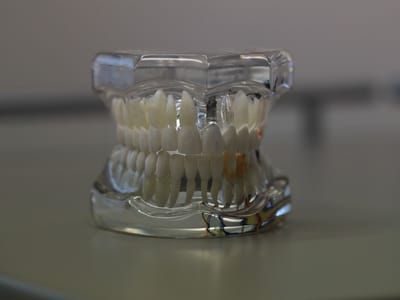 Affordable Dentist Near Me - Grand Prairie