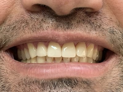 Albert M. Tsang DDS - Pinole General and Implant Dentistry