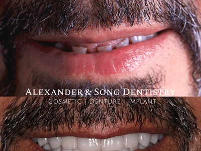 Alexander and Song Dentistry: Cosmetic, Denture, Implant