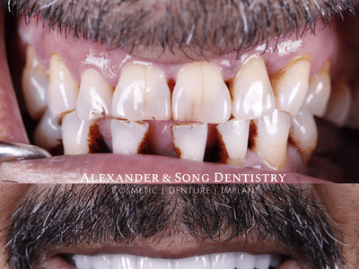 Alexander and Song Dentistry: Cosmetic, Denture, Implant
