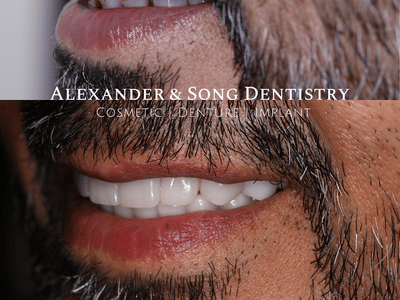 Alexander and Song Dentistry: Cosmetic, Denture, Implant